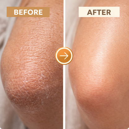 Deep Hydration Your Skin Can’t Get From Lotion