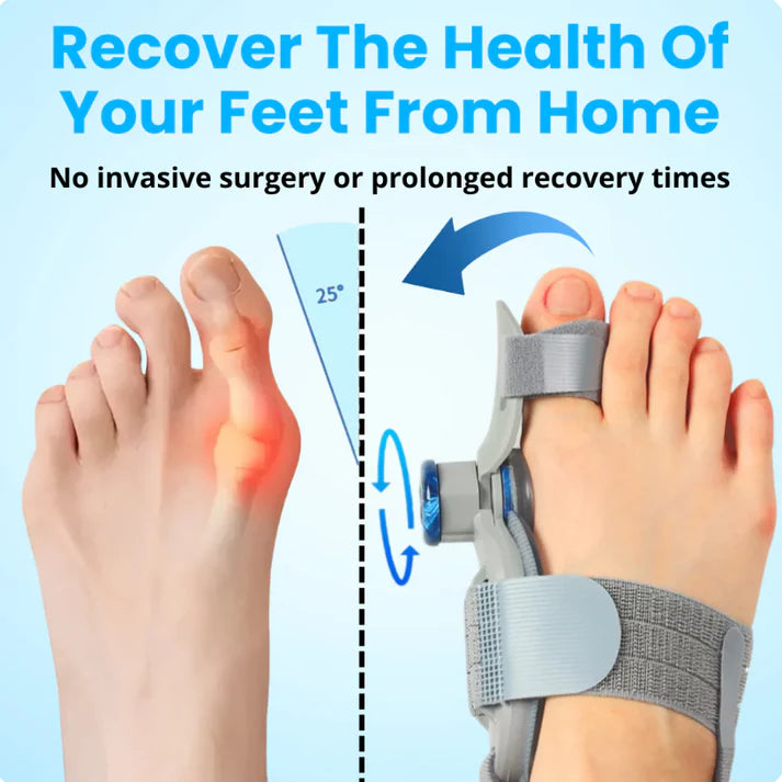 ComfortEase Bunion Relief